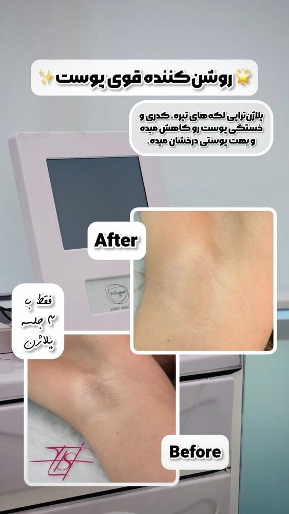  جدید ترین استوری اینستاگرام الناز شمی