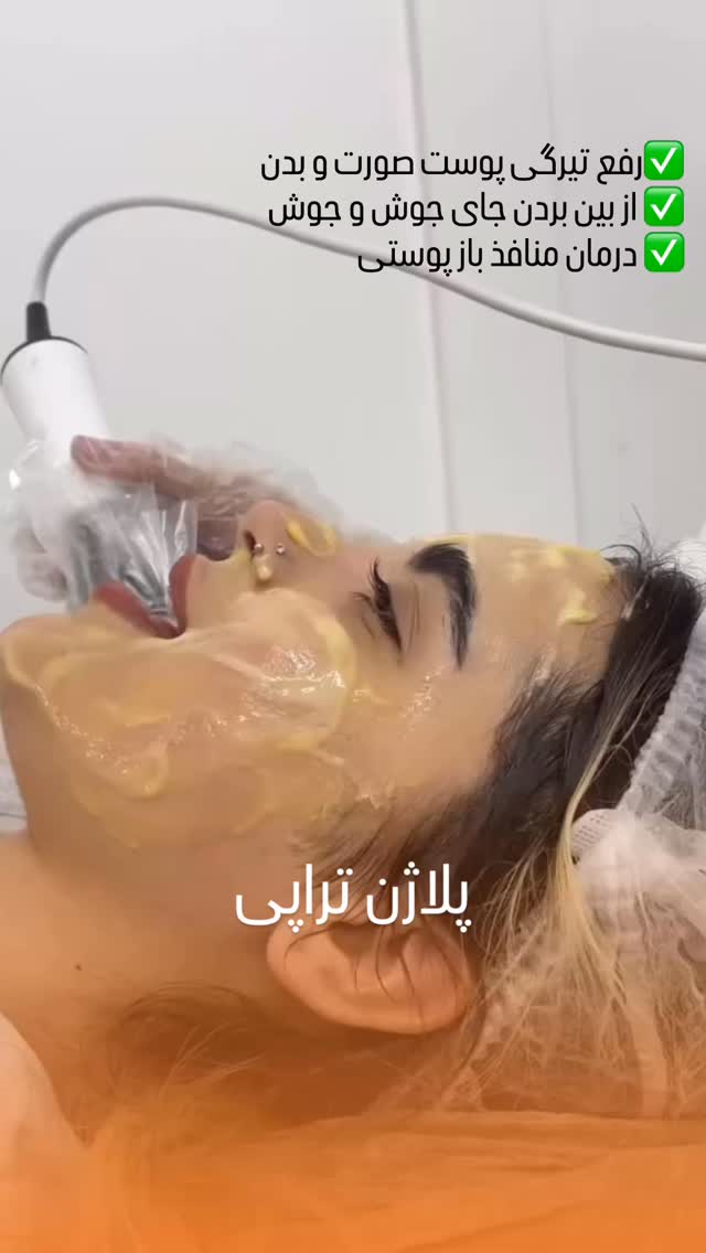  جدید ترین استوری اینستاگرام الناز شمی