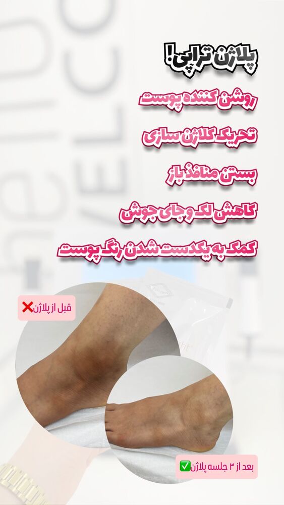  جدید ترین استوری اینستاگرام الناز شمی