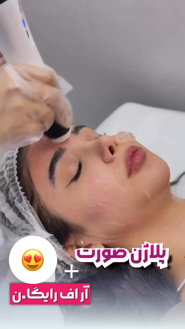  جدید ترین استوری اینستاگرام الناز شمی