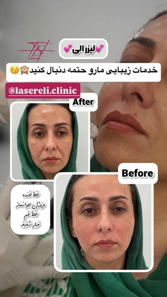  جدید ترین استوری اینستاگرام الناز شمی