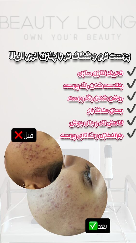  جدید ترین استوری اینستاگرام الناز شمی