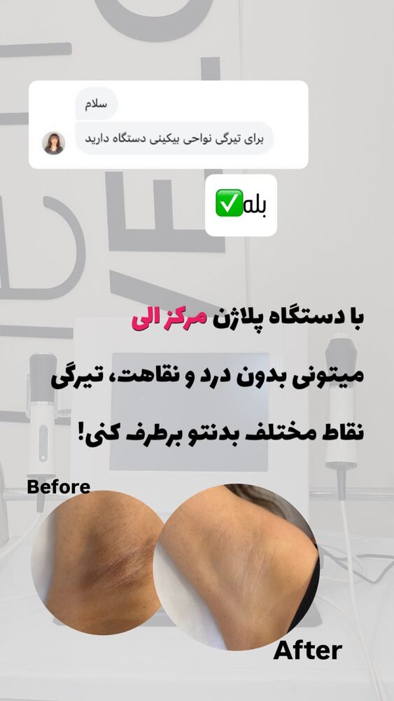  جدید ترین استوری اینستاگرام الناز شمی