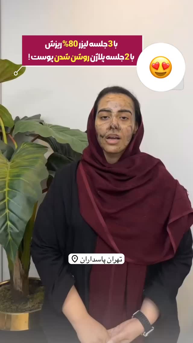  جدید ترین استوری اینستاگرام الناز شمی