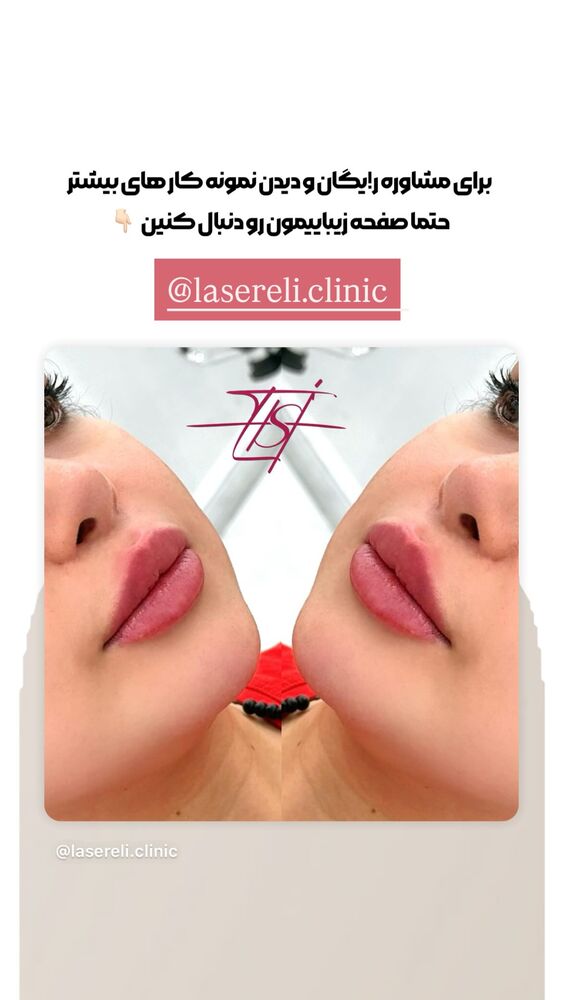  جدید ترین استوری اینستاگرام الناز شمی