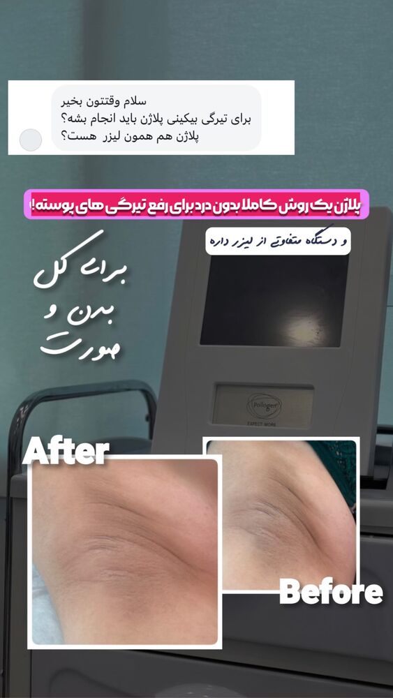  جدید ترین استوری اینستاگرام الناز شمی