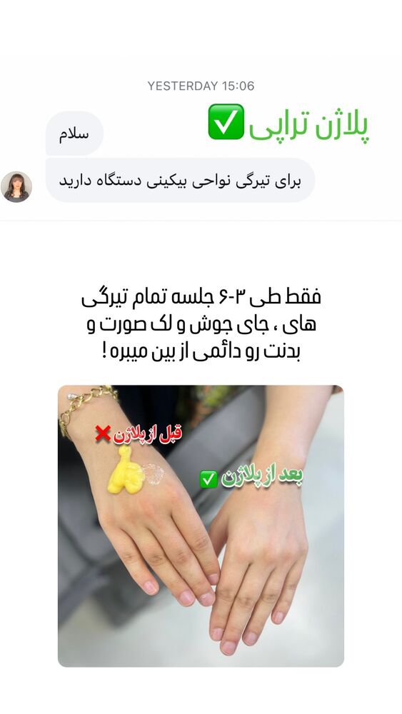 جدید ترین استوری اینستاگرام الناز شمی