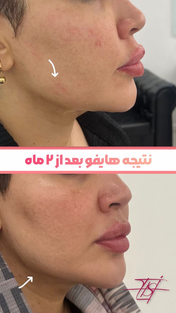  جدید ترین استوری اینستاگرام الناز شمی