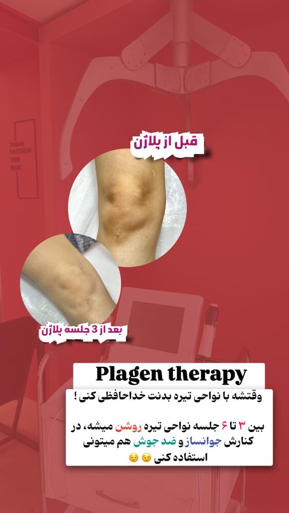  جدید ترین استوری اینستاگرام الناز شمی