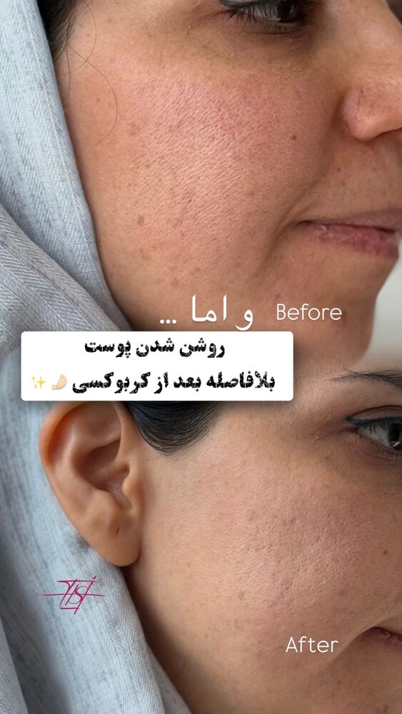  جدید ترین استوری اینستاگرام الناز شمی