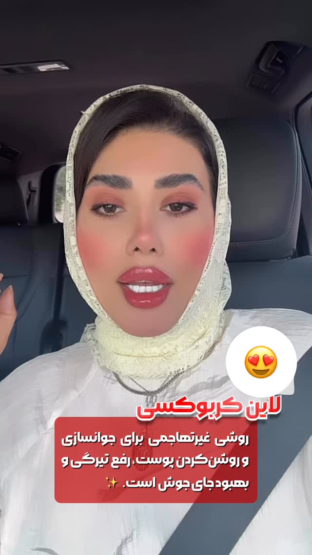  جدید ترین استوری اینستاگرام الناز شمی