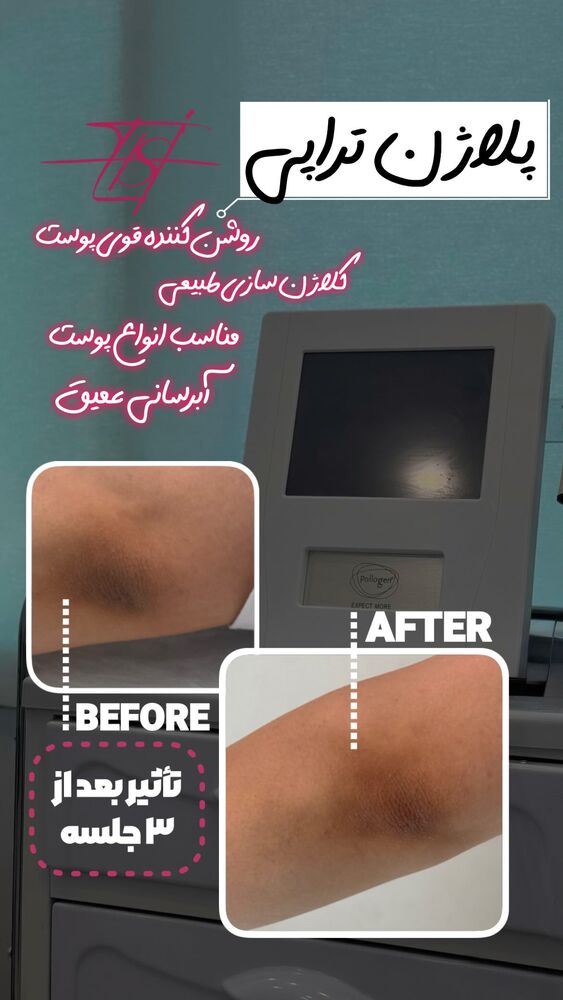 جدید ترین استوری اینستاگرام الناز شمی