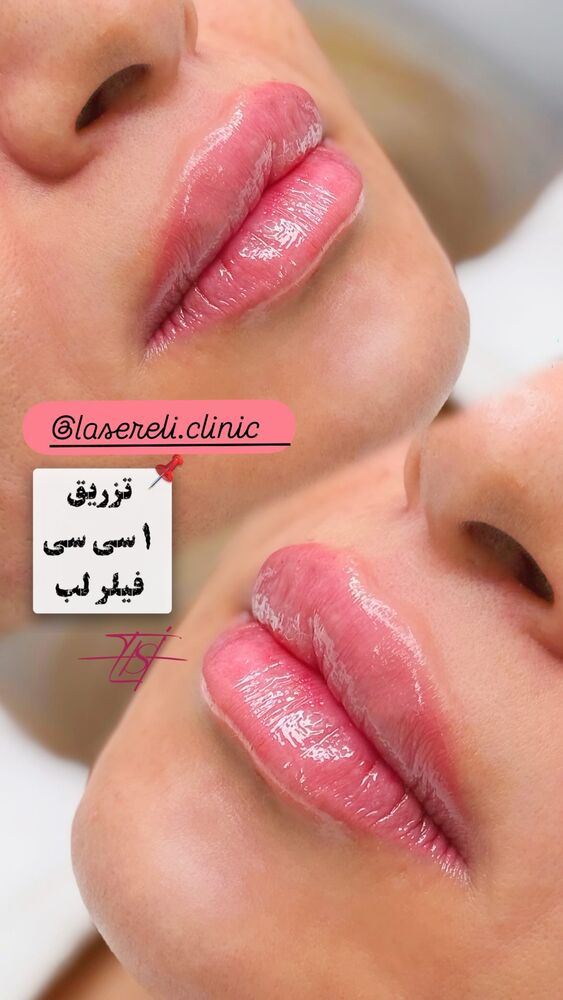  جدید ترین استوری اینستاگرام الناز شمی