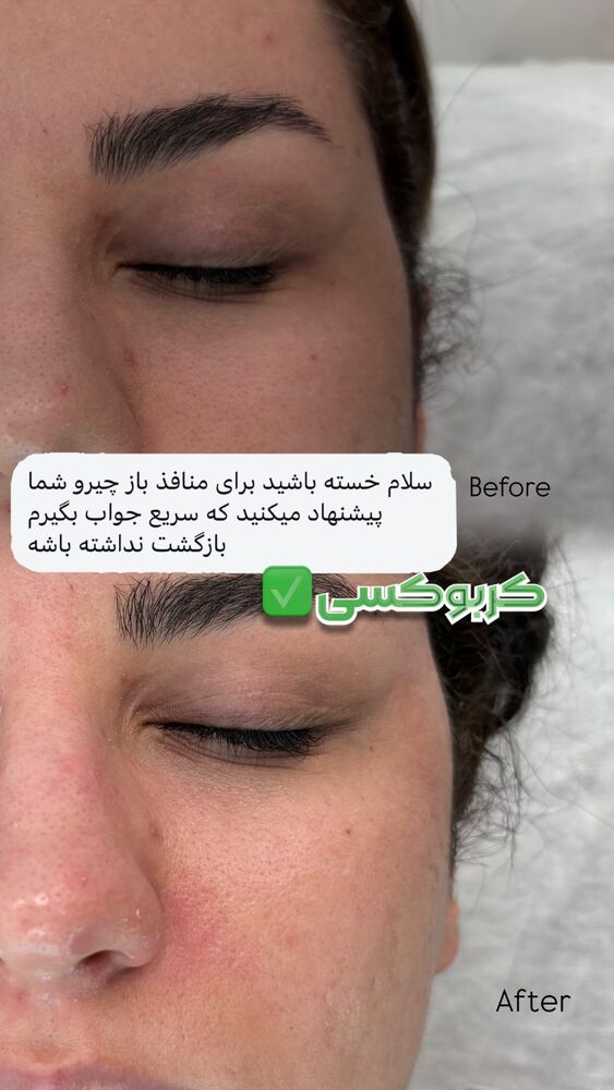  جدید ترین استوری اینستاگرام الناز شمی