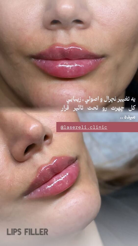  جدید ترین استوری اینستاگرام الناز شمی