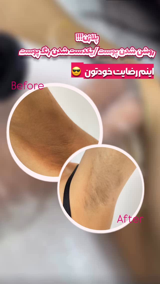  جدید ترین استوری اینستاگرام الناز شمی