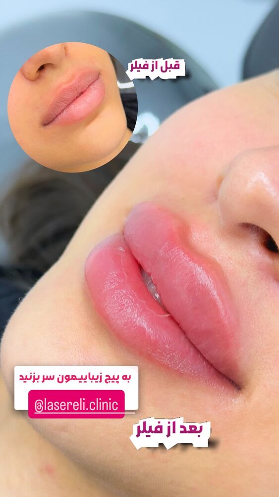  جدید ترین استوری اینستاگرام الناز شمی