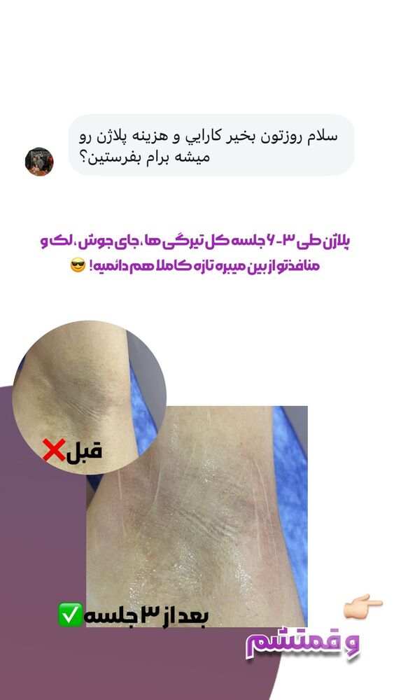  جدید ترین استوری اینستاگرام الناز شمی