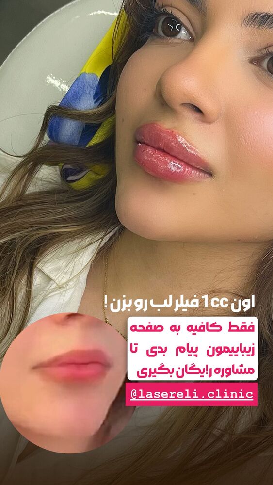  جدید ترین استوری اینستاگرام الناز شمی