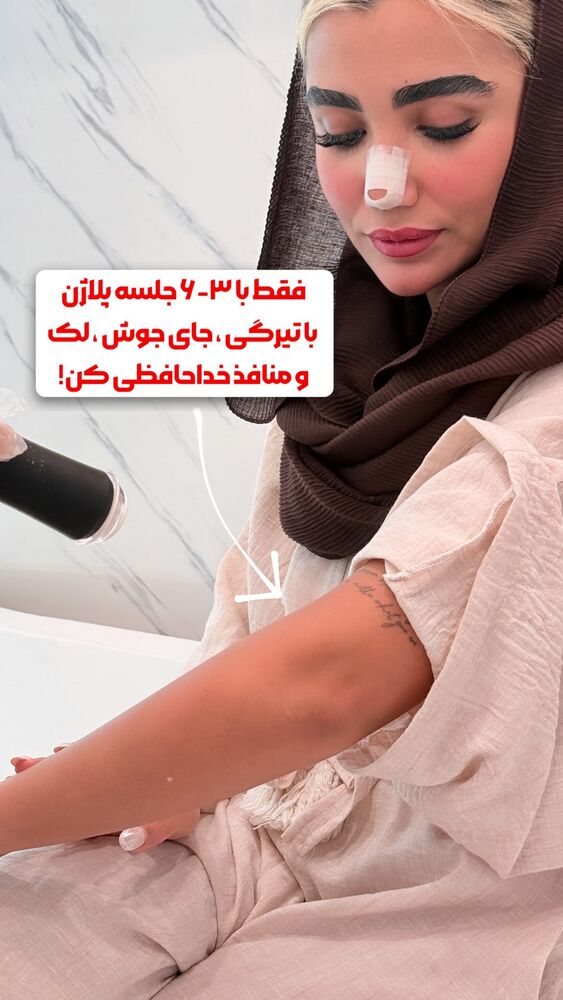  جدید ترین استوری اینستاگرام الناز شمی