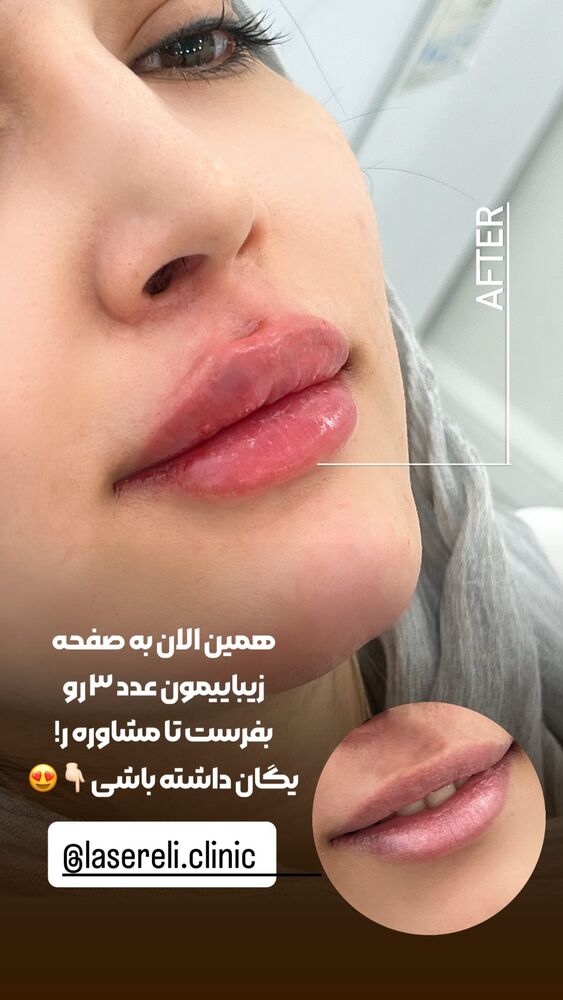  جدید ترین استوری اینستاگرام الناز شمی