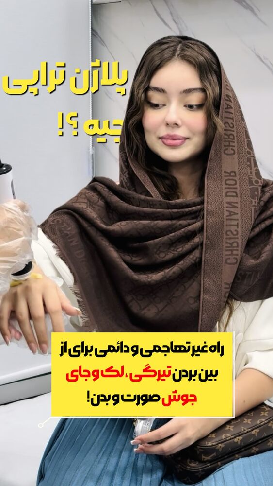  جدید ترین استوری اینستاگرام الناز شمی