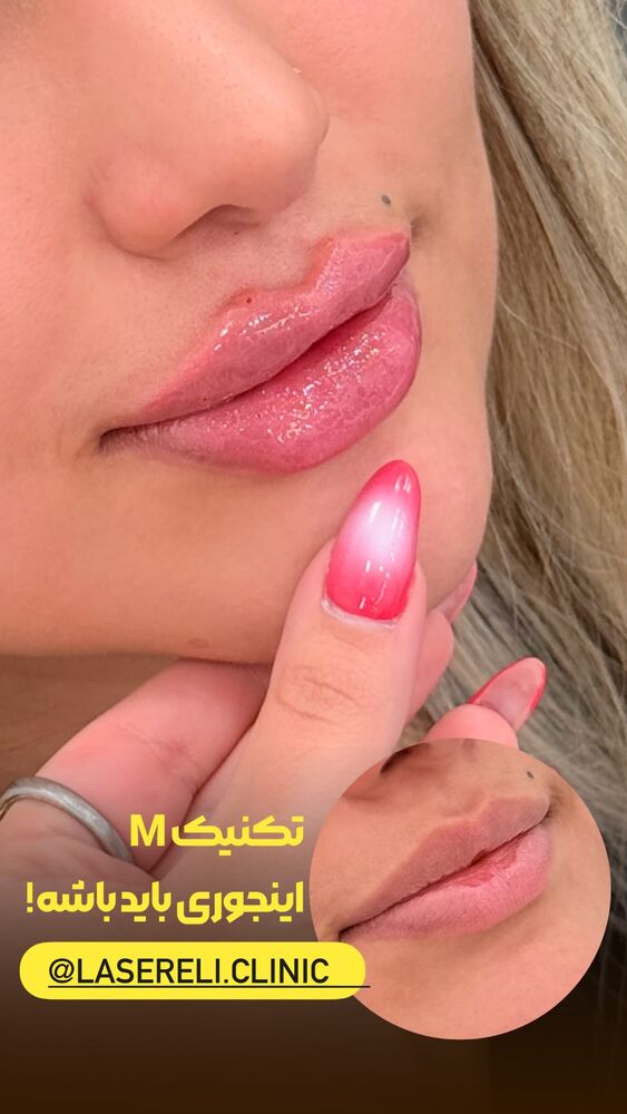  جدید ترین استوری اینستاگرام الناز شمی