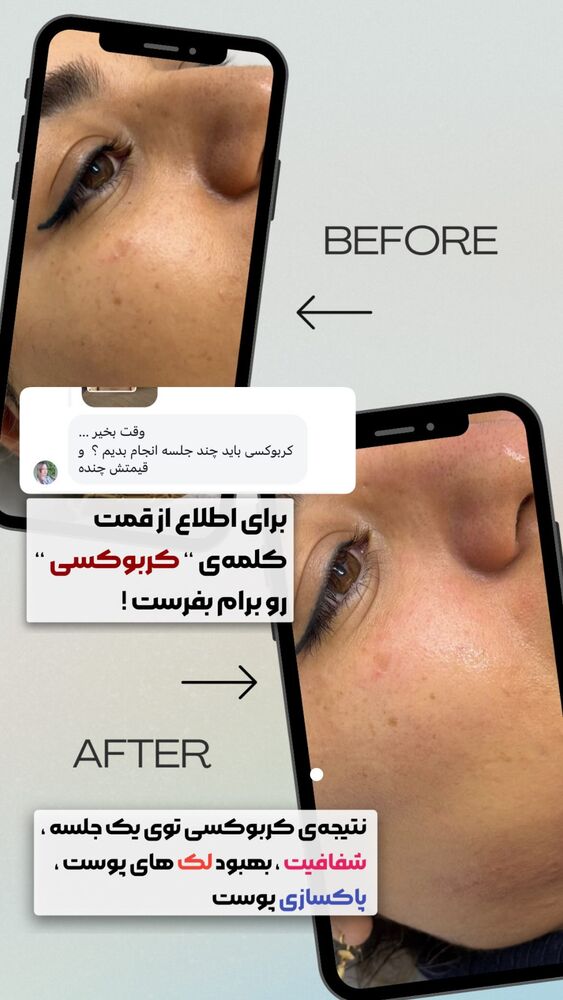  جدید ترین استوری اینستاگرام الناز شمی
