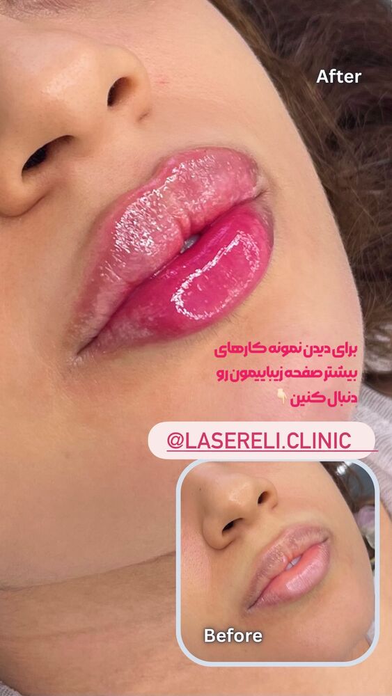  جدید ترین استوری اینستاگرام الناز شمی