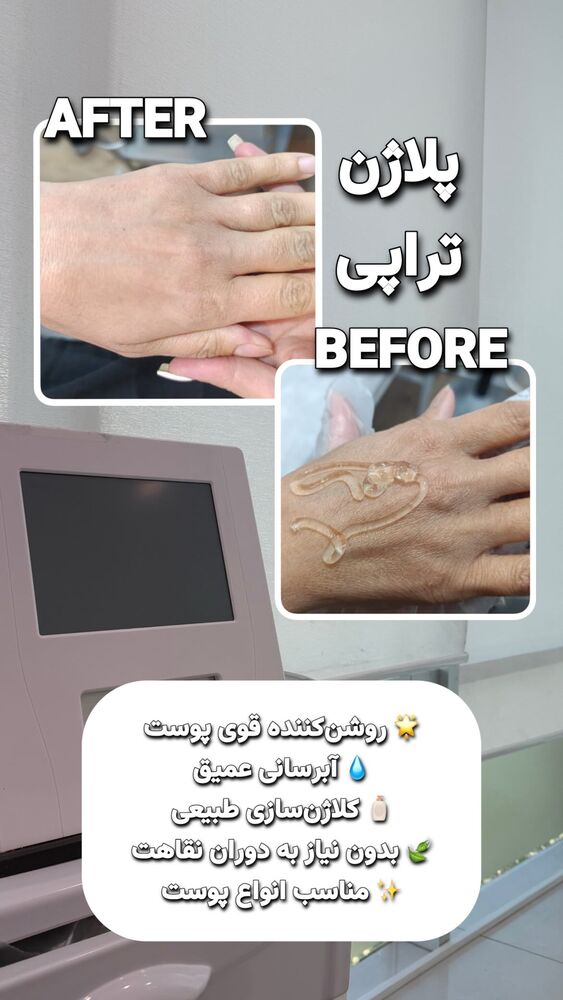  جدید ترین استوری اینستاگرام الناز شمی
