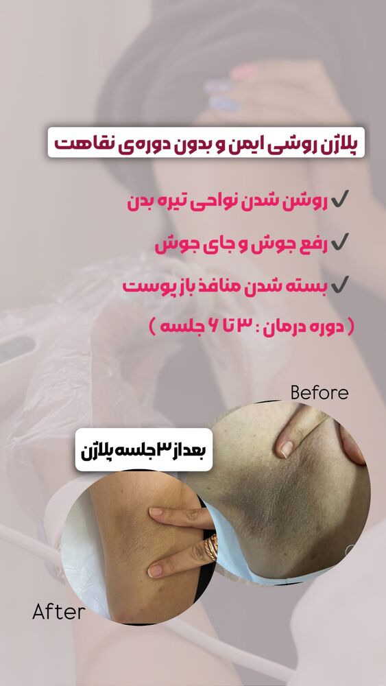  جدید ترین استوری اینستاگرام الناز شمی