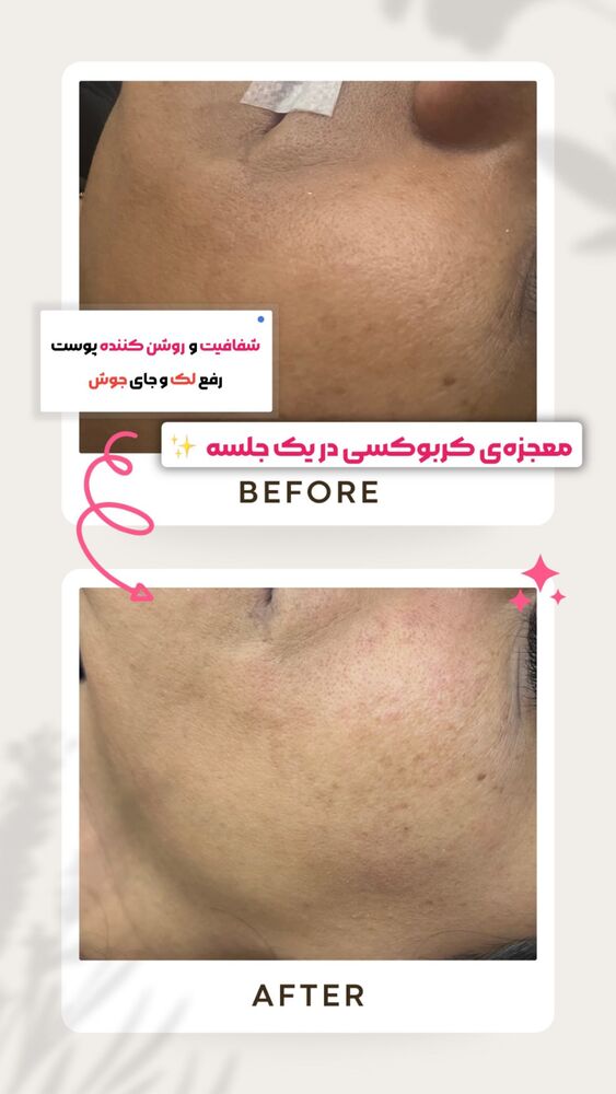  جدید ترین استوری اینستاگرام الناز شمی