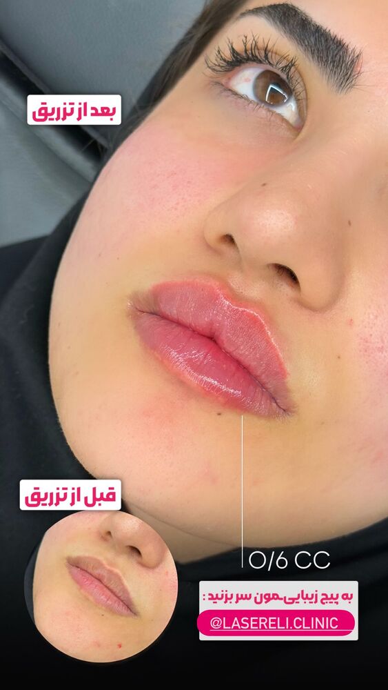  جدید ترین استوری اینستاگرام الناز شمی