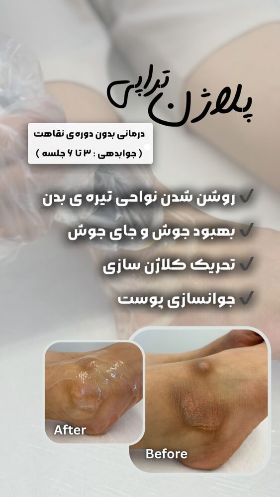  جدید ترین استوری اینستاگرام الناز شمی