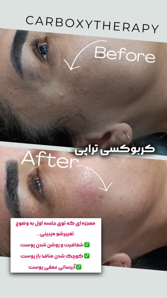  جدید ترین استوری اینستاگرام الناز شمی