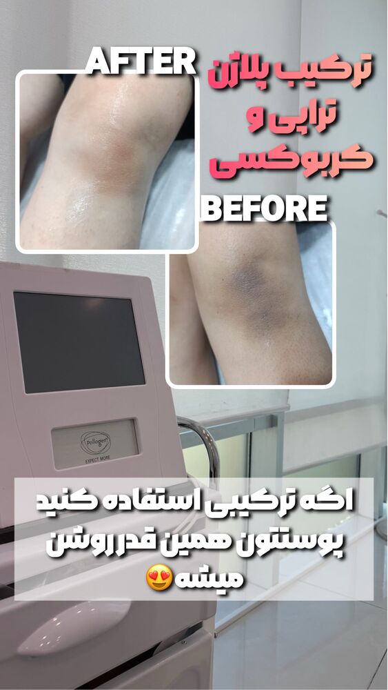  جدید ترین استوری اینستاگرام الناز شمی