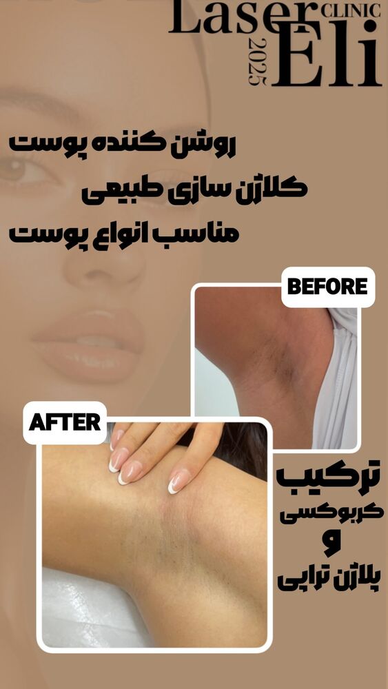  جدید ترین استوری اینستاگرام الناز شمی