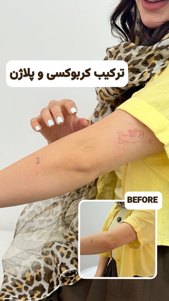  جدید ترین استوری اینستاگرام الناز شمی
