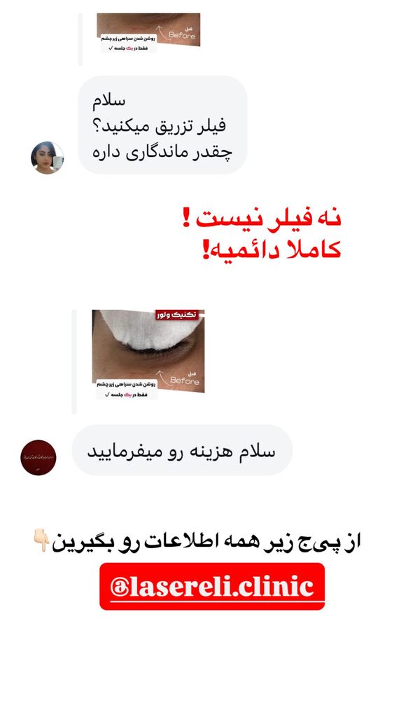  جدید ترین استوری اینستاگرام الناز شمی