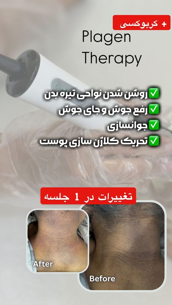  جدید ترین استوری اینستاگرام الناز شمی