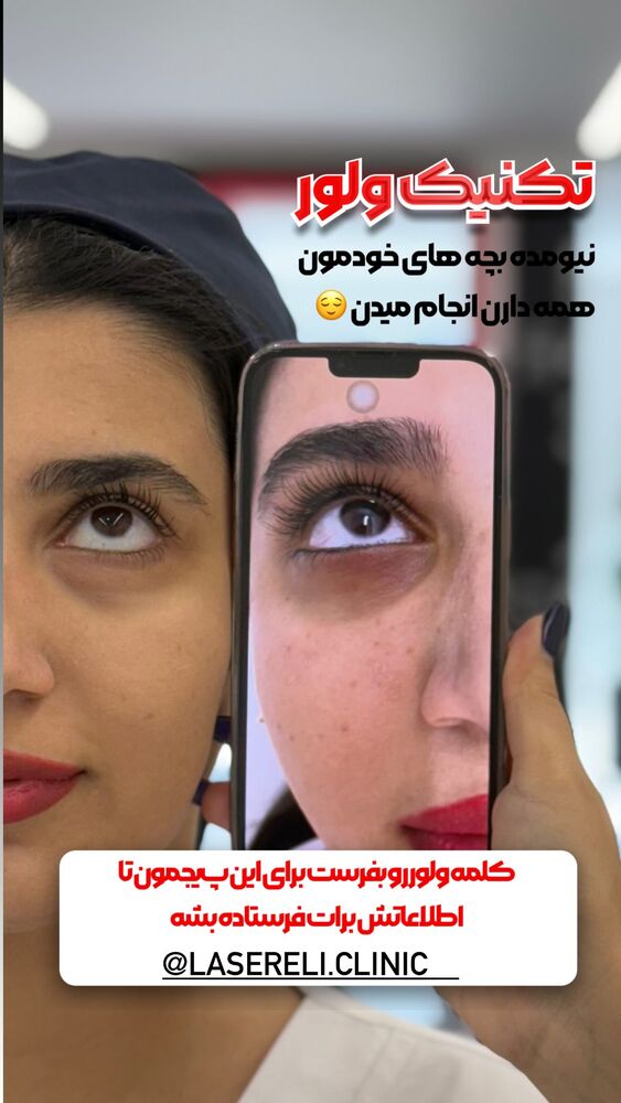  جدید ترین استوری اینستاگرام الناز شمی