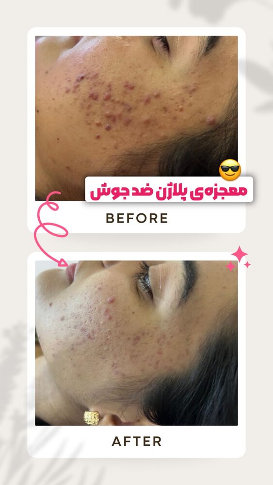  جدید ترین استوری اینستاگرام الناز شمی
