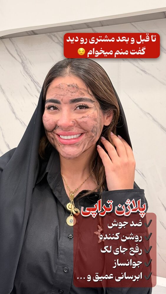  جدید ترین استوری اینستاگرام الناز شمی