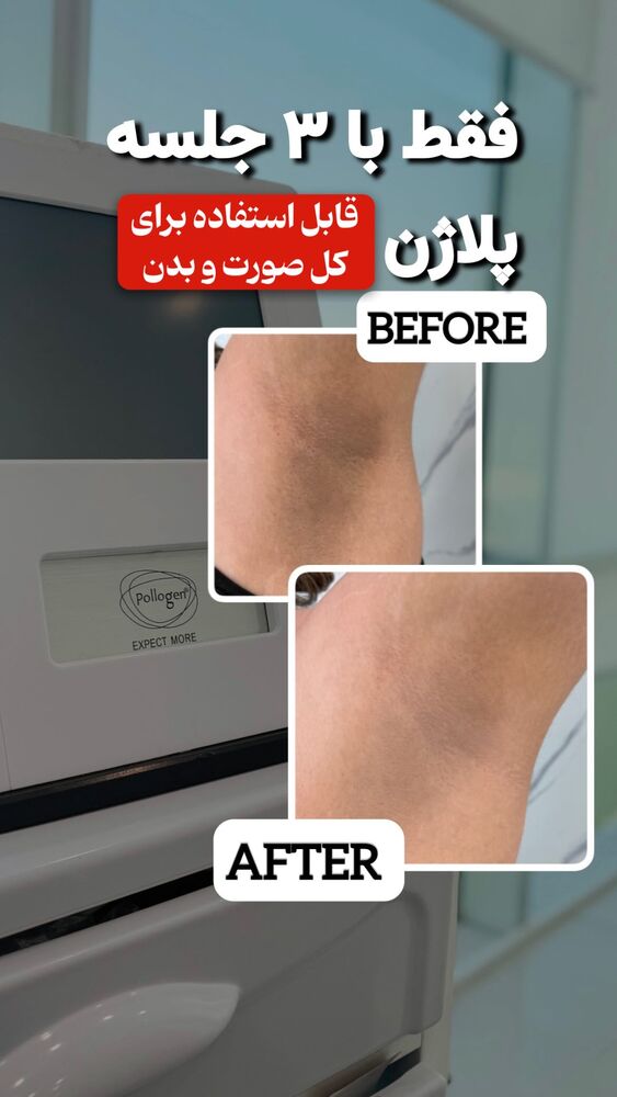  جدید ترین استوری اینستاگرام الناز شمی