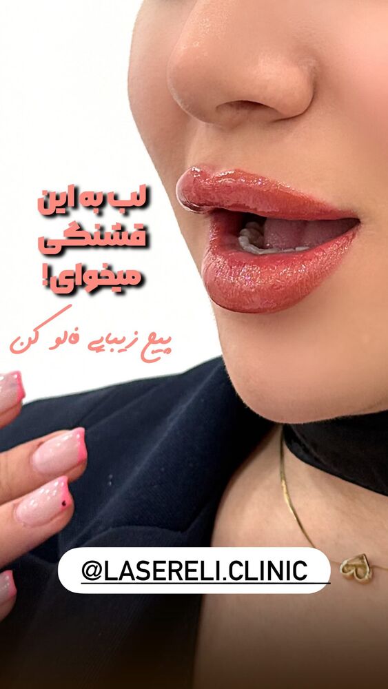  جدید ترین استوری اینستاگرام الناز شمی