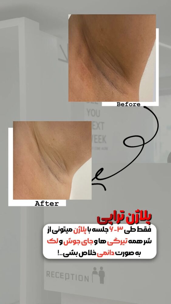  جدید ترین استوری اینستاگرام الناز شمی
