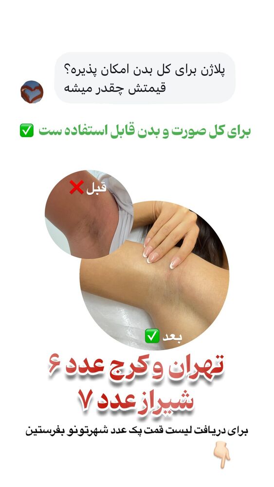  جدید ترین استوری اینستاگرام الناز شمی