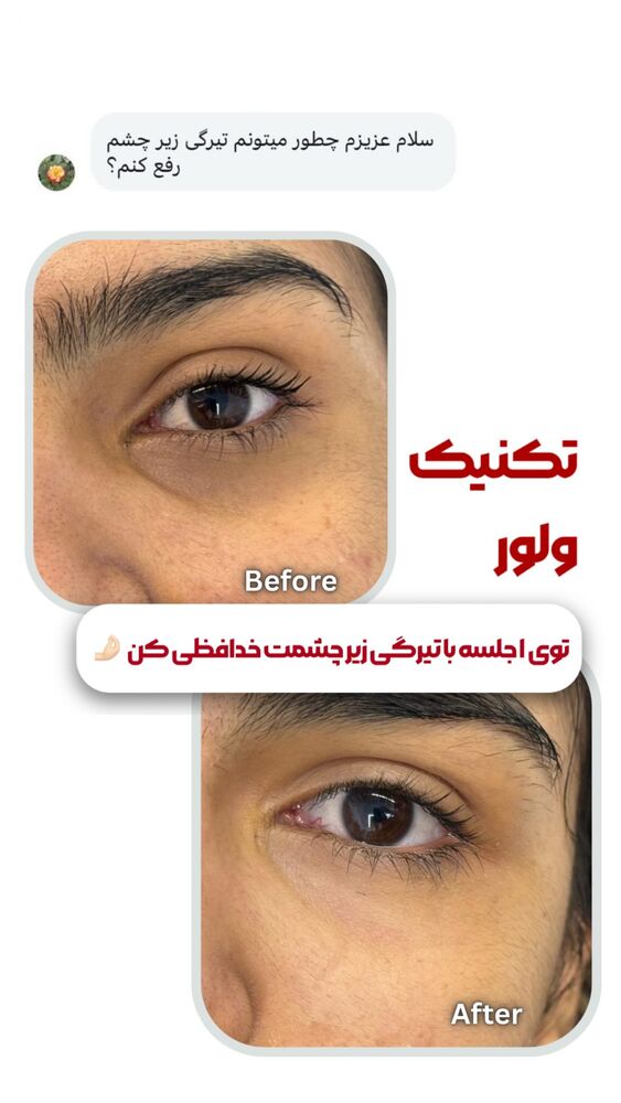  جدید ترین استوری اینستاگرام الناز شمی