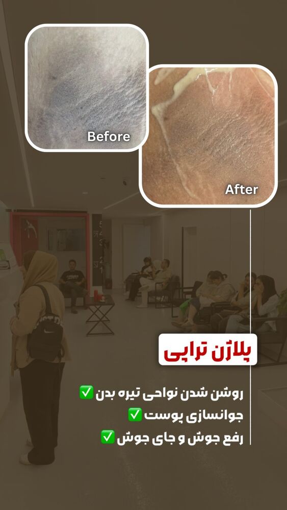  جدید ترین استوری اینستاگرام الناز شمی