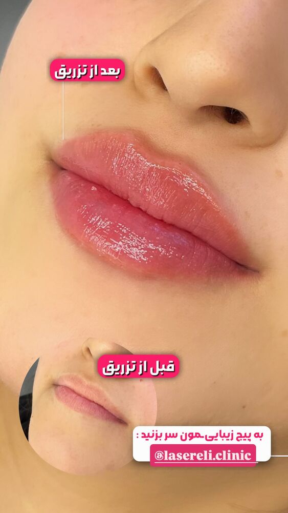  جدید ترین استوری اینستاگرام الناز شمی